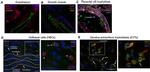 Vimentin Antibody in Immunohistochemistry (Paraffin) (IHC (P))