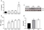 IBA1 Antibody in Western Blot (WB)