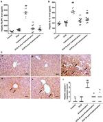 Caspase 1 Antibody in Immunohistochemistry (IHC)