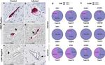 CD61 (Integrin beta 3) Antibody in Immunohistochemistry (Paraffin) (IHC (P))