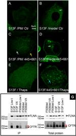 Filamin A Antibody in Western Blot (WB)