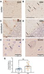 Ataxin 3 Antibody in Immunohistochemistry (IHC)