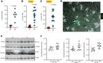 IFT88 Antibody in Western Blot (WB)