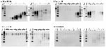 Tau Antibody in Western Blot (WB)