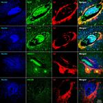 SMOC1 Antibody in Immunohistochemistry (IHC)