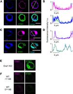 STIM1 Antibody in Immunocytochemistry (ICC/IF)