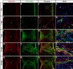 PDGF-D Antibody in Immunohistochemistry (IHC)