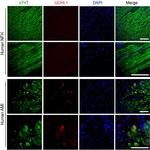 Cardiac Troponin T Antibody in Immunohistochemistry (IHC)