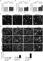 beta-3 Tubulin Antibody in Immunocytochemistry (ICC/IF)