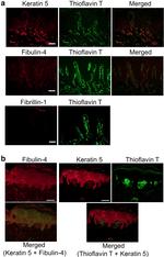 Cytokeratin 5 Antibody in Immunohistochemistry (IHC)