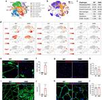 PDGFRA Antibody in Immunohistochemistry (PFA fixed) (IHC (PFA))