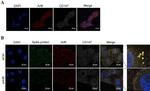 ARF6 Antibody in Immunocytochemistry (ICC/IF)