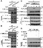 CaMKII alpha Antibody in Western Blot, Immunoprecipitation (WB, IP)