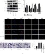 ZO-1 Antibody in Immunocytochemistry (ICC/IF)