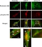 Phospho-FAK (Tyr397) Antibody in Immunocytochemistry (ICC/IF)