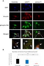 Phospho-FAK (Tyr397) Antibody in Immunocytochemistry (ICC/IF)