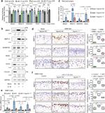 iNOS Antibody in Immunohistochemistry (IHC)