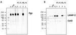 P-Glycoprotein Antibody in Western Blot (WB)