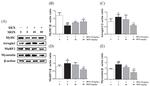 Myostatin Antibody in Western Blot (WB)