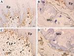 Vimentin Antibody in Immunohistochemistry (IHC)