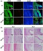 iNOS Antibody in Immunohistochemistry (IHC)