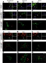 HuD Antibody in Immunohistochemistry (Frozen), Immunohistochemistry (Paraffin) (IHC (F), IHC (P))