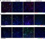 CLEC4F Antibody in Immunohistochemistry (IHC)