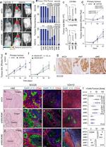 CD44 Antibody in Immunohistochemistry (IHC)