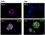 CD274 (PD-L1, B7-H1) Antibody in Immunohistochemistry (Paraffin) (IHC (P))