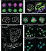 SOX2 Antibody in Immunohistochemistry (IHC)