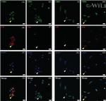 Vimentin Antibody in Immunocytochemistry (ICC/IF)