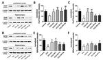 ChAT Antibody in Western Blot (WB)