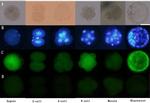 Estrogen Receptor beta Antibody in Immunocytochemistry (ICC/IF)