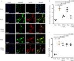 ADAMTS4 Antibody in Immunocytochemistry (ICC/IF)