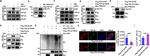 LC3B Antibody in Immunocytochemistry (ICC/IF)