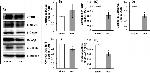 beta Catenin Antibody in Western Blot (WB)