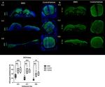 Doublecortin Antibody in Immunohistochemistry (IHC)