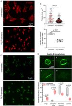 Septin 2 Antibody in Immunocytochemistry (ICC/IF)