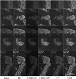 Cardiac Troponin T Antibody in Immunocytochemistry (ICC/IF)