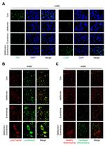 SQSTM1 Antibody in Immunohistochemistry (IHC)