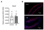 NOX4 Antibody in Immunohistochemistry (IHC)