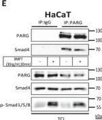 Rabbit IgG (H+L) Secondary Antibody in Western Blot, Immunoprecipitation (WB, IP)