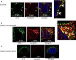 Rabbit IgG (H+L) Highly Cross-Adsorbed Secondary Antibody in Immunocytochemistry (ICC/IF)