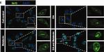 Rabbit IgG (H+L) Cross-Adsorbed Secondary Antibody in Immunocytochemistry (ICC/IF)