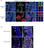 Mouse IgG (H+L) Cross-Adsorbed Secondary Antibody in Immunohistochemistry (Paraffin) (IHC (P))