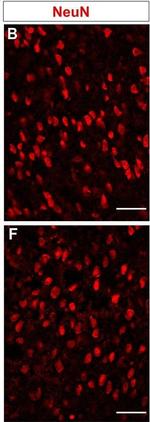 Mouse IgG (H+L) Cross-Adsorbed Secondary Antibody in Immunohistochemistry (IHC)