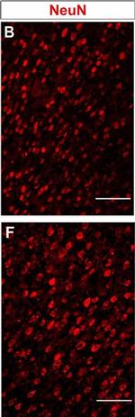 Mouse IgG (H+L) Cross-Adsorbed Secondary Antibody in Immunohistochemistry (IHC)