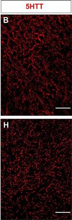 Mouse IgG (H+L) Cross-Adsorbed Secondary Antibody in Immunohistochemistry (IHC)