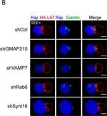 Mouse IgG (H+L) Cross-Adsorbed Secondary Antibody in Immunocytochemistry (ICC/IF)