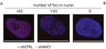 Mouse IgG (H+L) Cross-Adsorbed Secondary Antibody in Immunocytochemistry (ICC/IF)